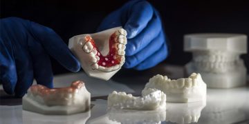 Benefits of 3D Printing in Dentistry