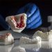 Benefits of 3D Printing in Dentistry